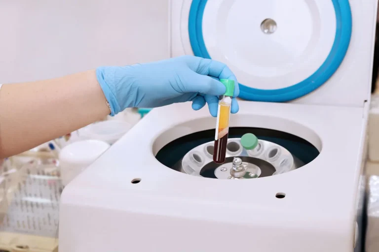 Is O Negative Plasma Worth More?