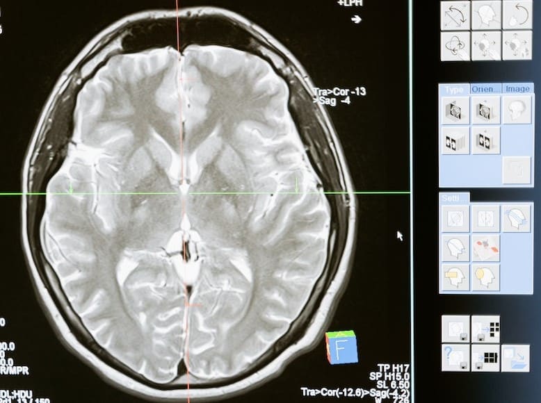 How Much is the Human Brain Worth